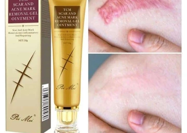 Scar removal cream