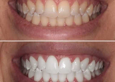 Dental services
