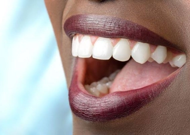 Dental services