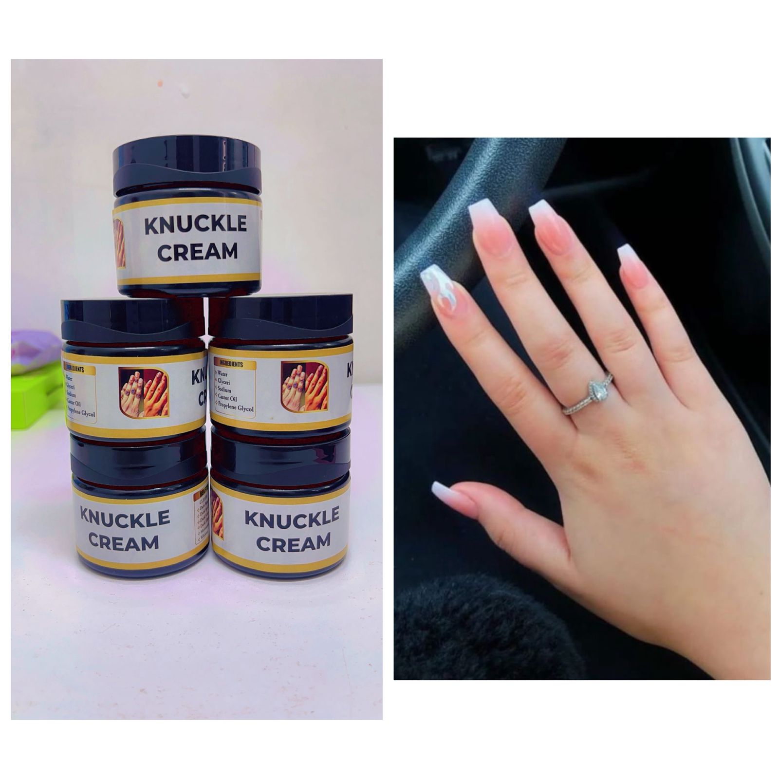 Knuckles remover cream