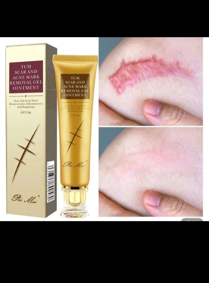 Scar removal cream