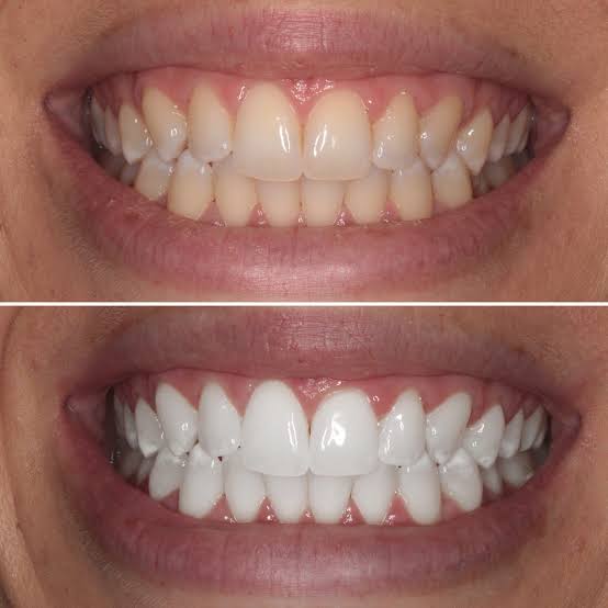 Dental services
